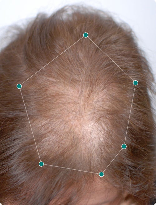 Hair Wellness from Within | Nutrafol Hair Wellness from Within | Nutrafol